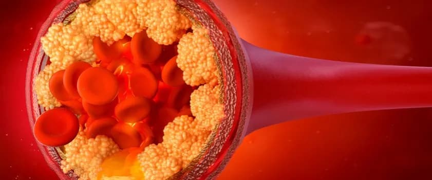 Czy leki na cholesterol obniżają ciśnienie? Sprawdź ich wpływ!