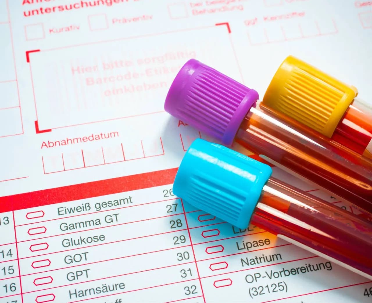 Jak obniżyć cholesterol przed badaniem i poprawić wyniki testu