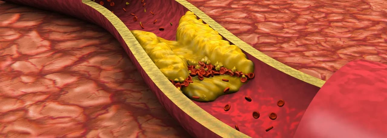Jakie są normy cholesterolu i jak uniknąć zdrowotnych zagrożeń